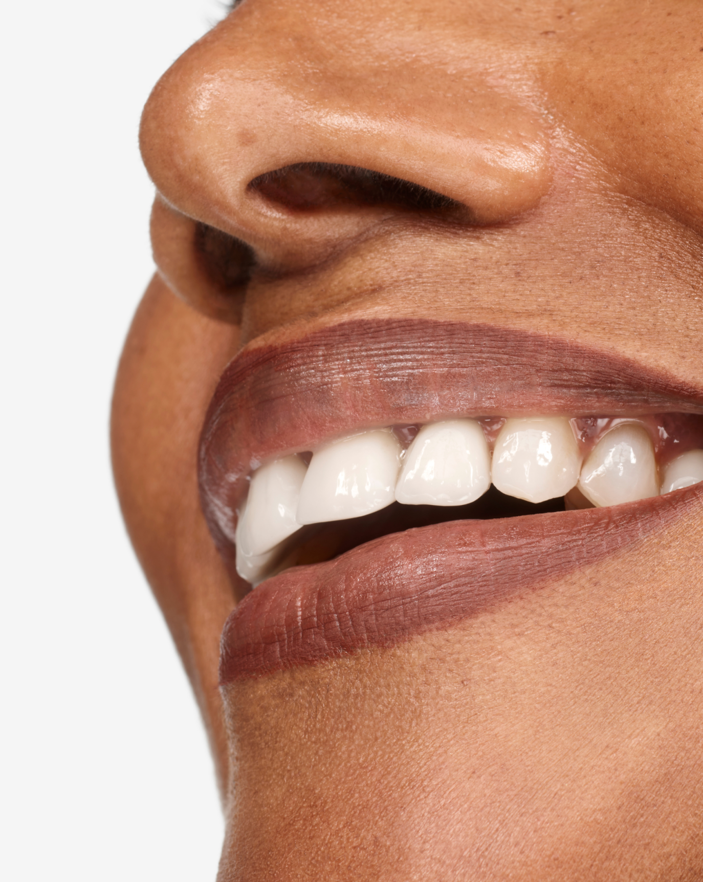 Lip Line