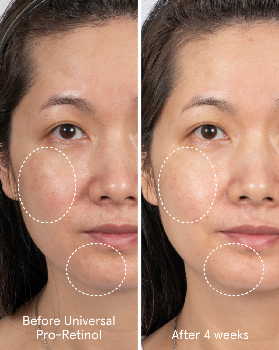 Universal Pro-Retinol